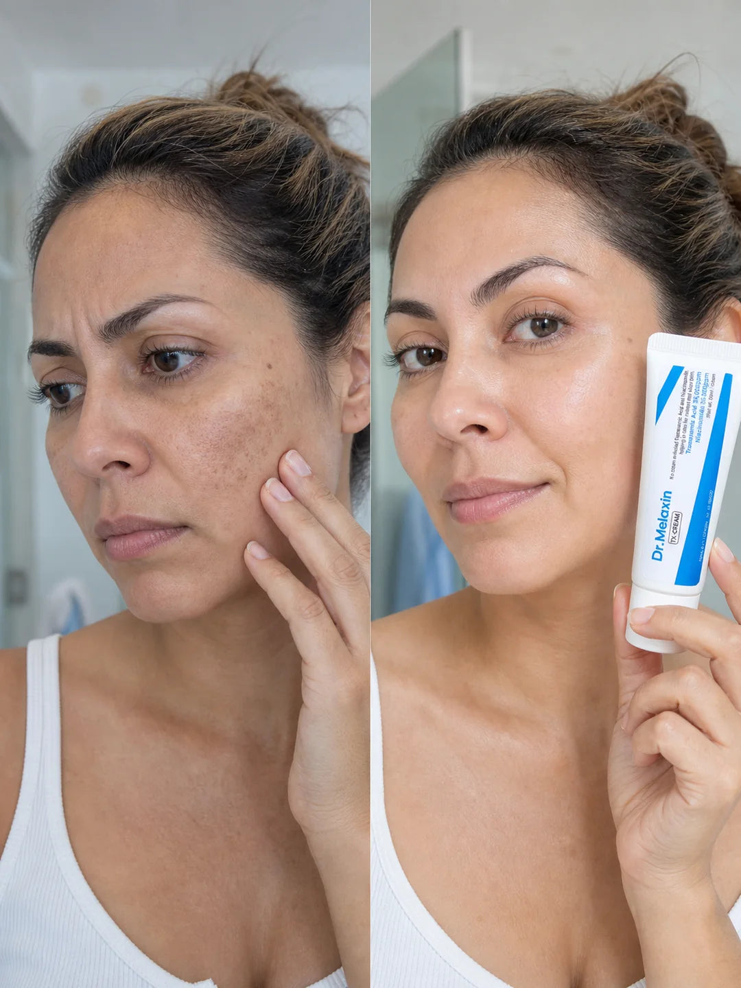Mujer preocupada por manchas en la piel y la misma mujer mostrando Dr. Melaxin TX Cream